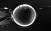 Stem cells Stem cells